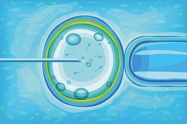 Capacitation and In Vitro Maturation in IVF lab