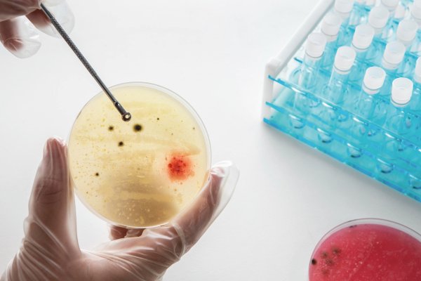 DNA Fragmentation Index (DFI) sperm DNA test in andrology laboratory
