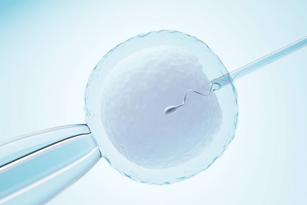 ICSI micromanipulation procedure