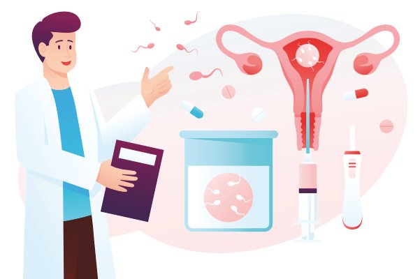 Intrauterine insemination procedure