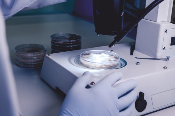 In Vitro Maturation (IVM) procedure in IVF laboratory