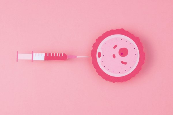 Ovarian Platelet Rich Plasma (PRP) Therapy in fertility clinic