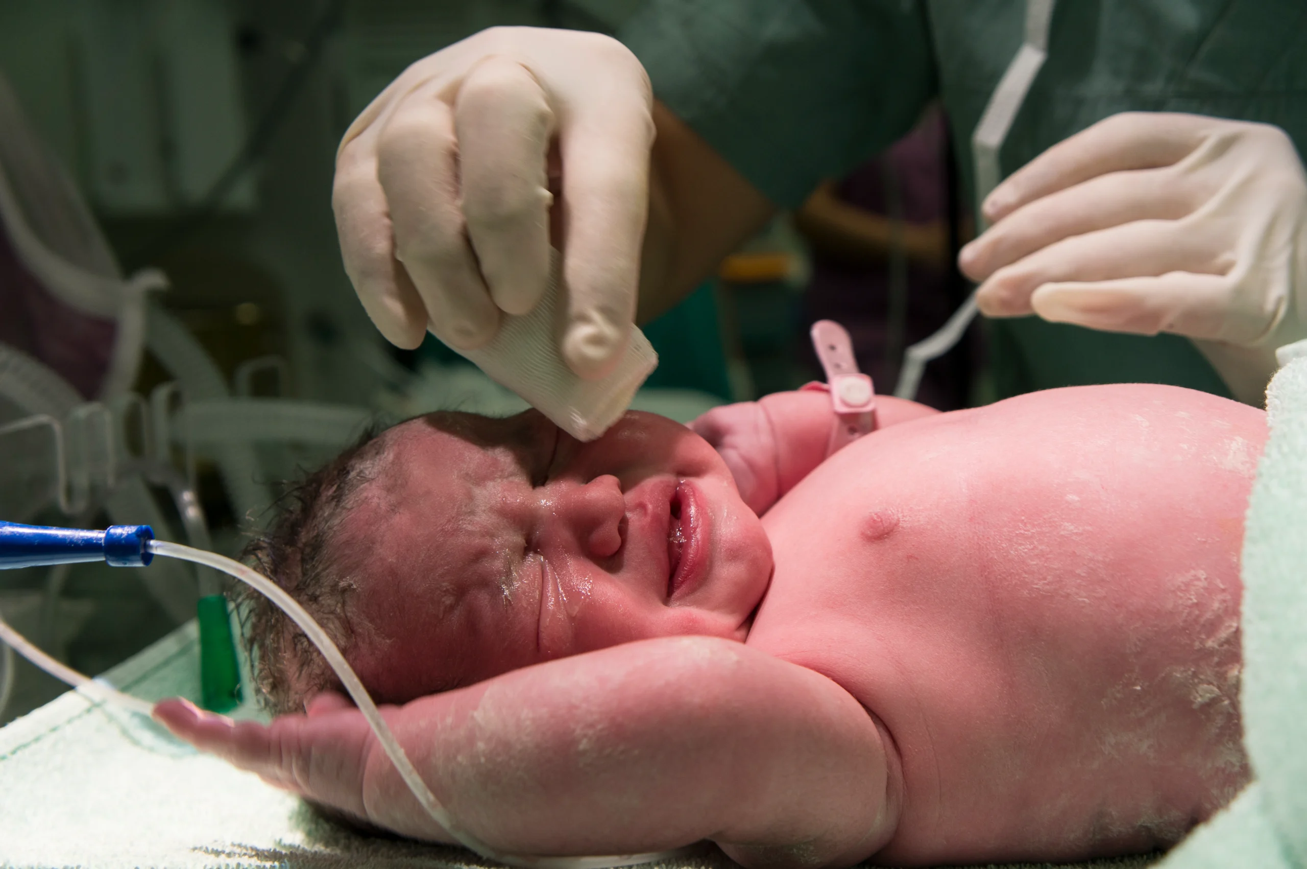 NT Scan Sonography in PCMC, Pune